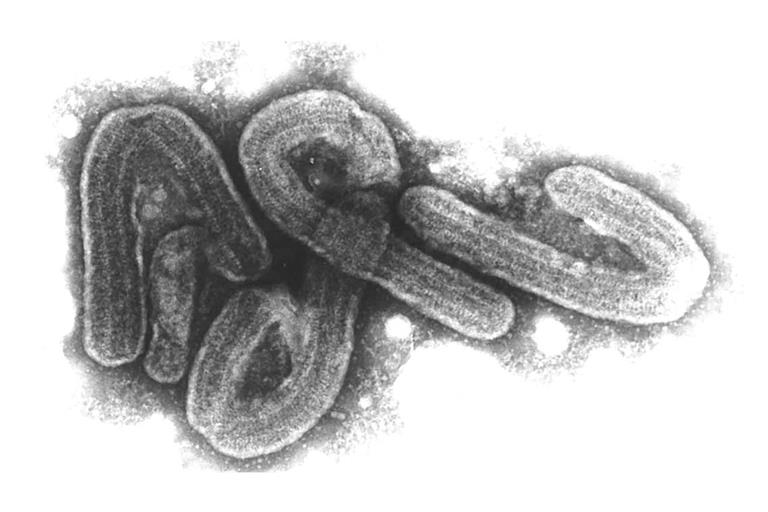 Das Marburg-Virus gehört zu den gefährlichsten bekannten Krankheitserregern.