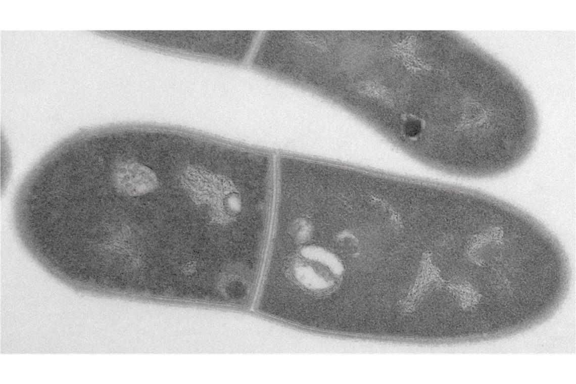 Das undatierte Handout zeigt eine Transmissionselektronenmikroskopische Aufnahme eines Bakteriums Corynebacterium glutamicum mit Speicherstoffen wie Polyphosphat und Lipidtröpfchen.