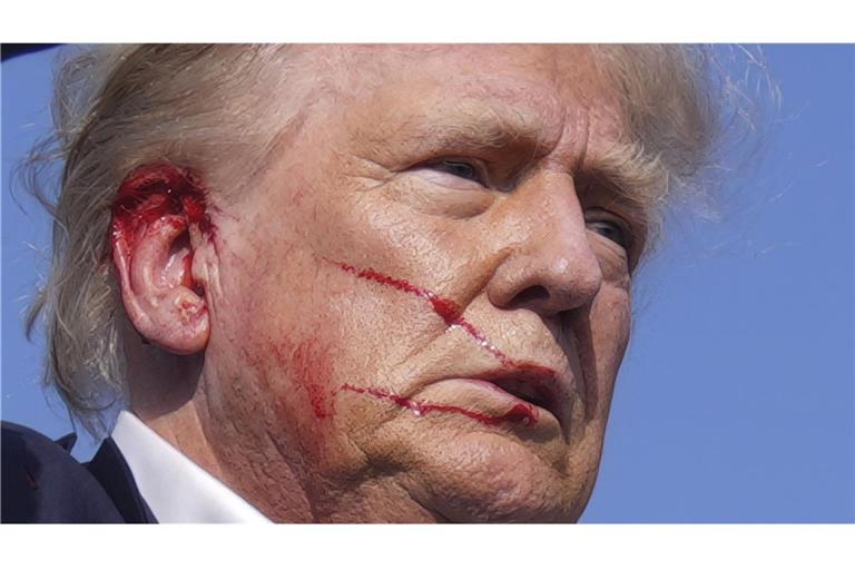 Die Kugel des Attentäters streifte US-Präsidentschaftskandidat Donald Trump am Ohr. (Archivbild)