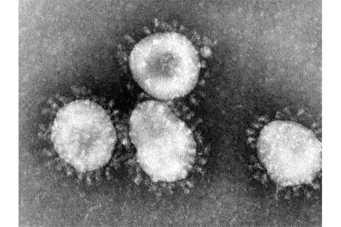 1508 Neuinfektionen im Südwesten: 105 neue Todesfälle Ein Coronavirus unter dem Mikroskop. Foto: Center for Disease Control/epa/dpa/Archivbild