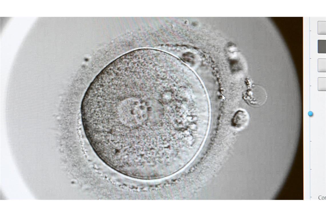 Ein Zweizeller nach einer künstlichen Befruchtung. Entwickelt er sich gut, kann er in die Gebärmutter transferiert werden.