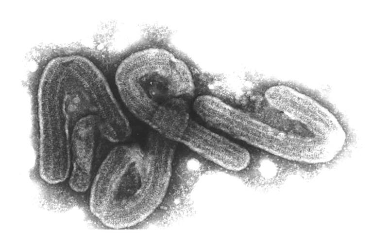 Eine elektronenmikroskopische Aufnahme des Marburg-Virus. (Archivbild)