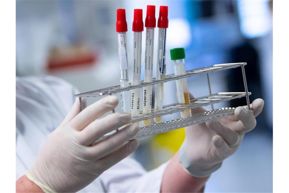 Noch sechs Kreise im Land mit Inzidenz-Wert über 100 Eine Laborantin bereitet Corona-Proben für die weitere Analyse vor. Foto: Sven Hoppe/dpa/Symbolbild