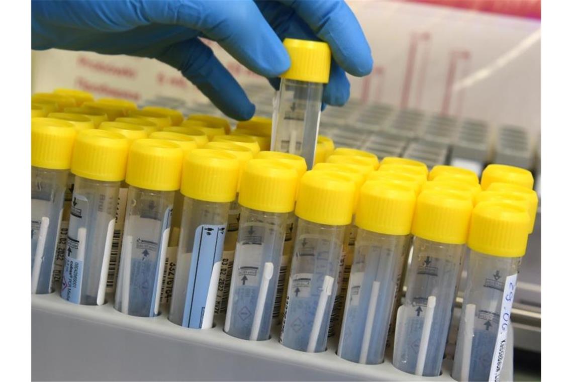 RKI vermeldet leicht gesunkene Sieben-Tage-Inzidenz Eine medizinisch technische Laborassistentin bereitet die Bearbeitung von PCR-Tests in einem Labor vor. Foto: Waltraud Grubitzsch/dpa