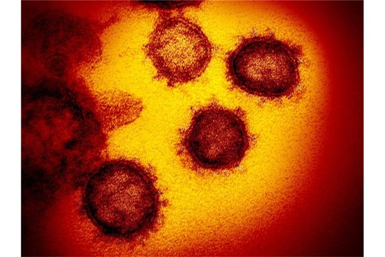 Eine undatierte elektronenmikroskopische Aufnahme des Coronavirus (SARS-CoV-2). Foto: NIAID-RML/AP/dpa