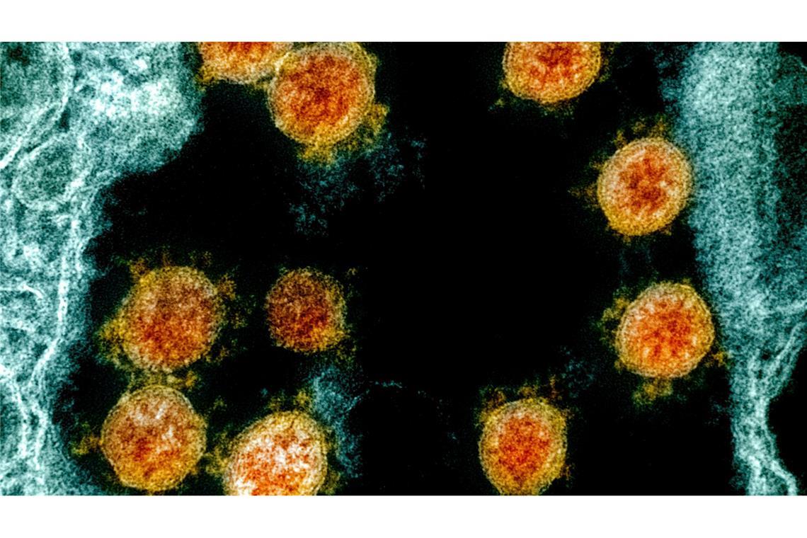 Elektronenmikroskopische Aufnahme des Coronavirus SARS-CoV-2.