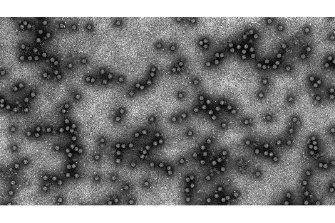 Elektronenmikroskopische Aufnahme des Maul- und Klauenseuche-Virus