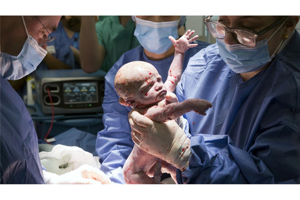 Kleines Wunder: Baby nach Gebärmuttertransplantation geboren Es soll der erste solche Fall in Großbritannien gewesen sein.