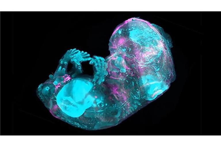 Forscher haben bis auf die Zellebene entschlüsselt, wie das Skelett eines menschlichen Embryos entsteht und wächst.