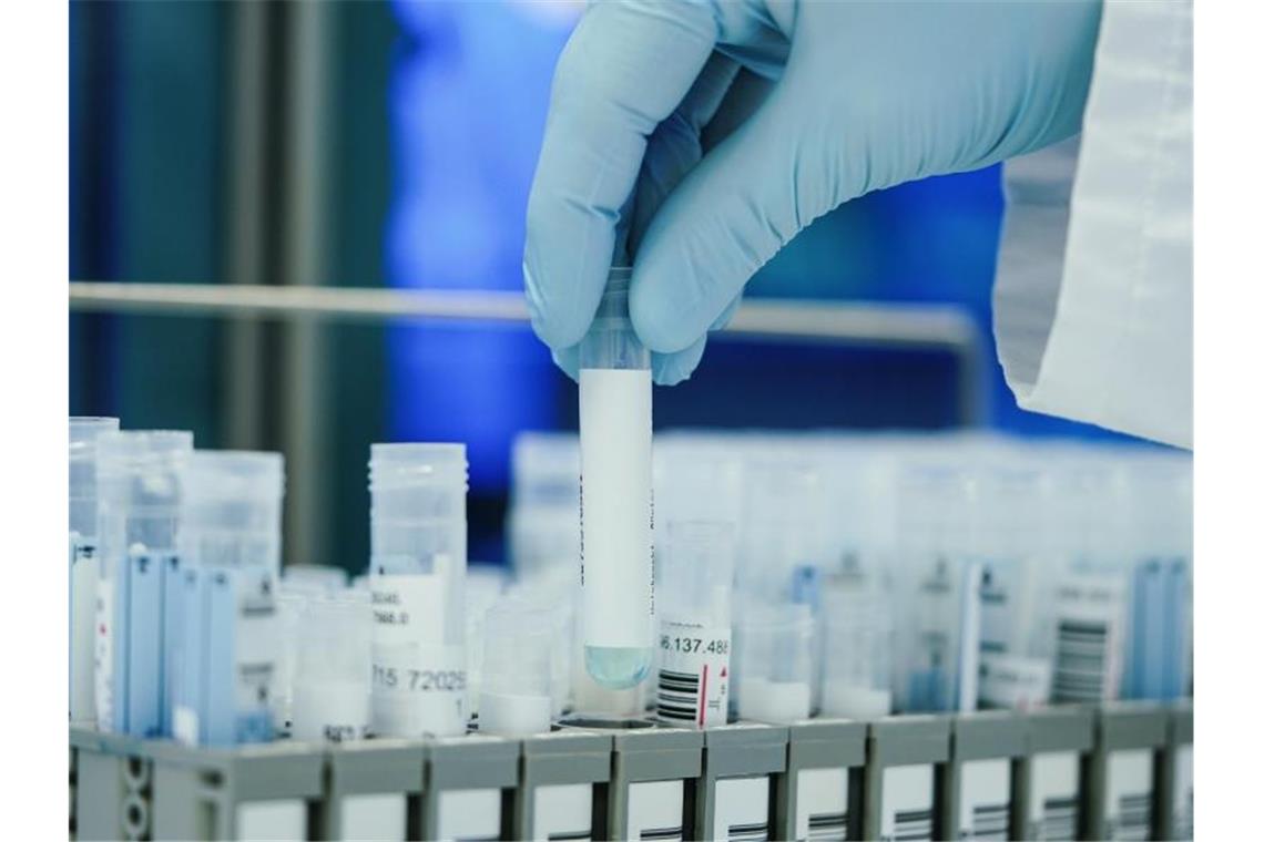 PCR-Tests werden knapp - Zweitimpfung bei Johnson&Johnson In den Laboren werden zurzeit so viele PCR-Tests gemacht wie noch nie. Foto: Uwe Anspach/dpa
