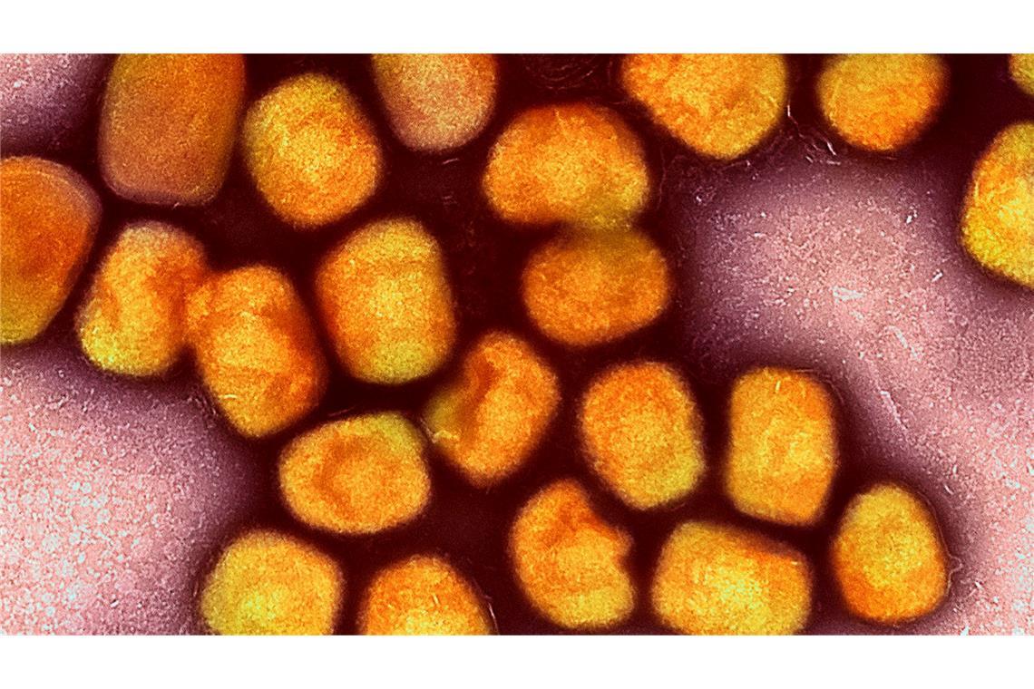 In Deutschland ist zum zweiten Mal die neue Variante des Mpox-Virus nachgewiesen worden, vier Mitglieder einer Familie im Rheinisch-Bergischen Kreis bei Köln sind erkrankt (Archivbild).