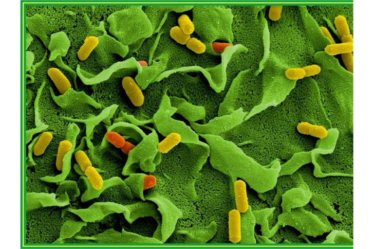 Listerien unter einem Elektronenmikroskop. Foto: Manfred Rohde/Helmholtz-Zentrum für Infektionsforschung/dpa