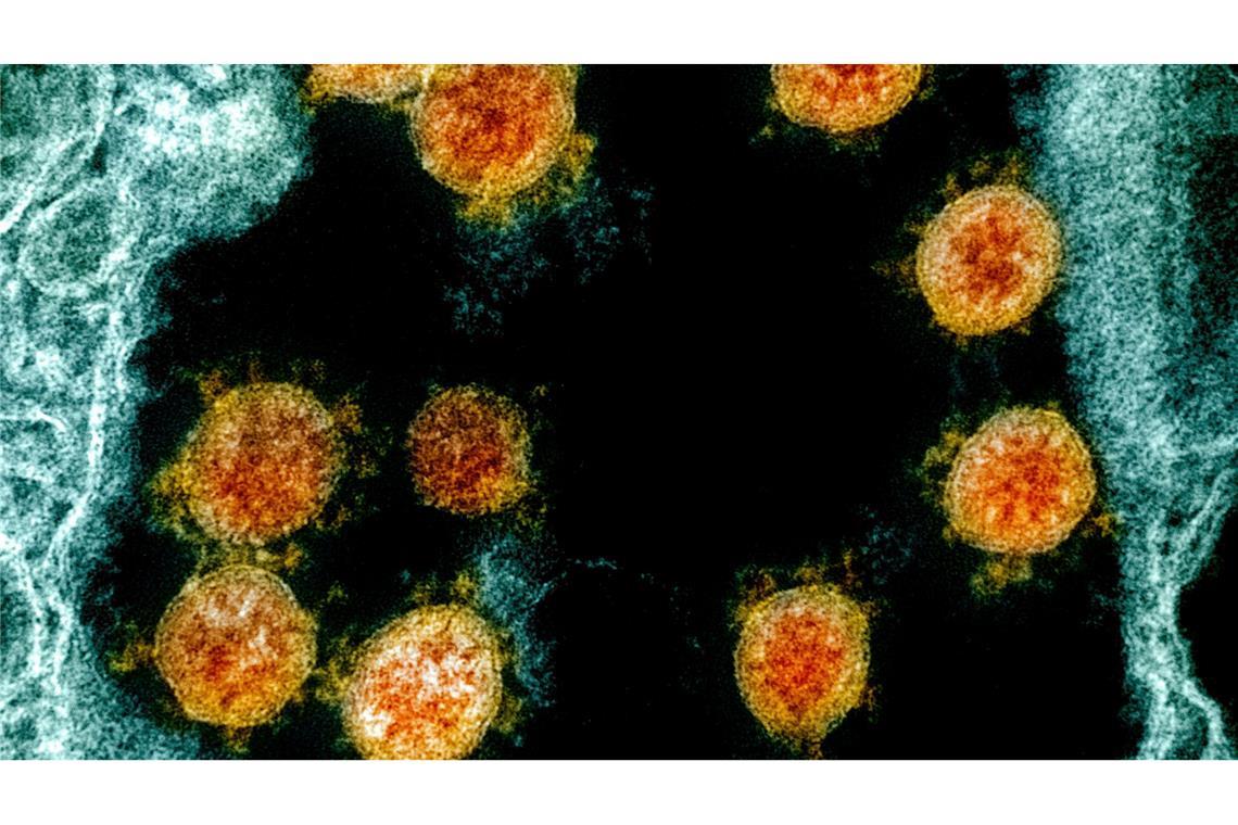 Partikel des Coronavirus SARS-CoV-2 wurden für eine elektronenmikroskopische Aufnahme farblich bearbeitet.