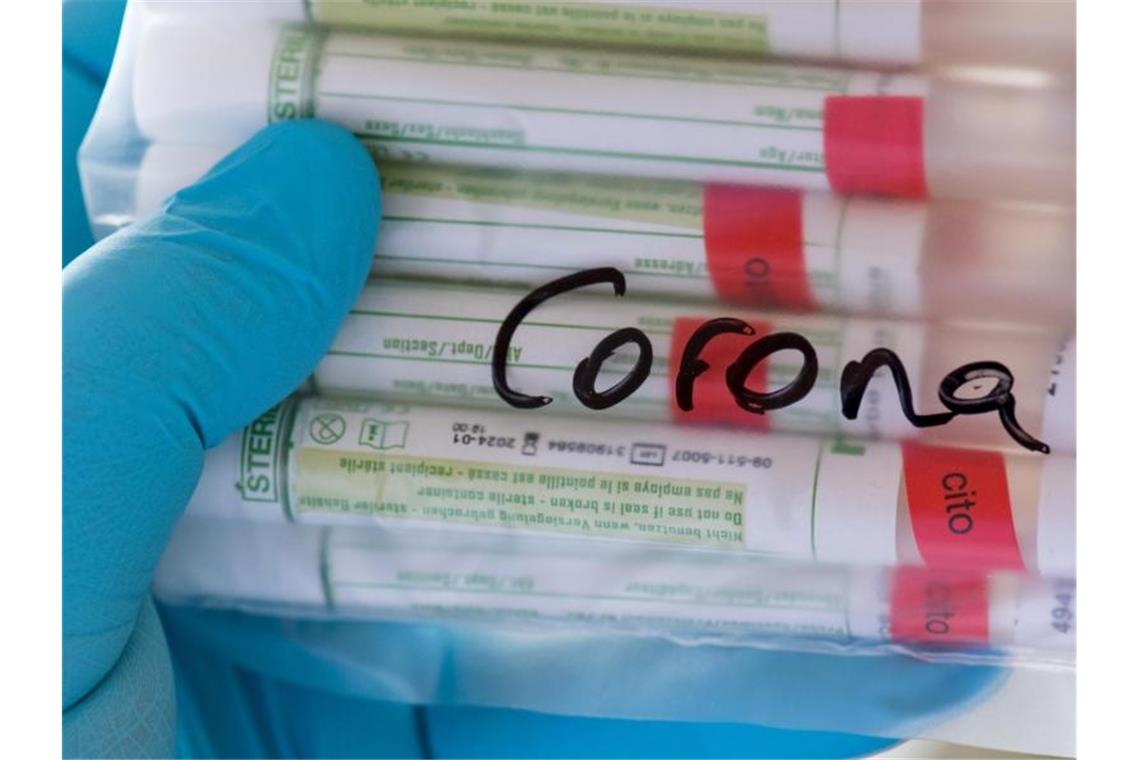 Klinik in Rottweil nach Corona-Häufung abgeschottet Proben für Corona-Tests werden für die weitere Untersuchung vorbereitet. Foto: Hendrik Schmidt/dpa-Zentralbild/ZB/Archivbild