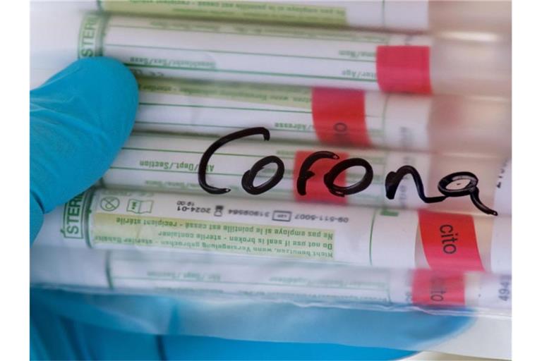 Proben für Corona-Tests werden im Diagnosticum-Labor für eine Untersuchung vorbereitet. Foto: Hendrik Schmidt/dpa-Zentralbild/Symbolbild