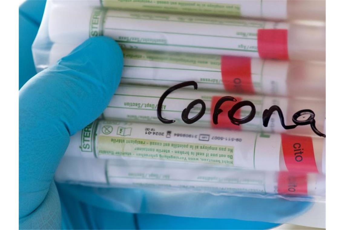 Proben für Corona-Tests werden im Labor für die weitere Untersuchung vorbereitet. Foto: Hendrik Schmidt/dpa-Zentralbild/Symbolbild