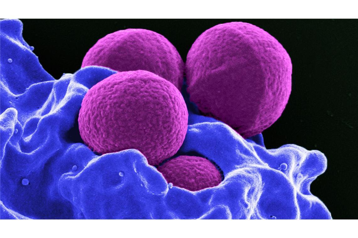 Produziert vom National Institute of Allergy and Infectious Diseases (NIAID) zeigt diese digital gefärbte Rasterelektronenmikroskopie (REM) vier magentafarbene, kugelförmige Methicillin-resistente Staphylococcus aureus (MRSA) Bakterien, die von blau gefärbten weißen Blutkörperchen (WBCs) phagozysiert werden.